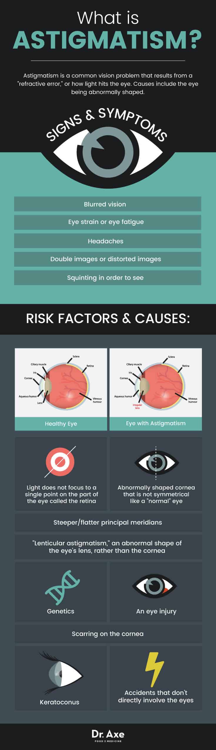 astigmatism symptoms, risk factors & causes