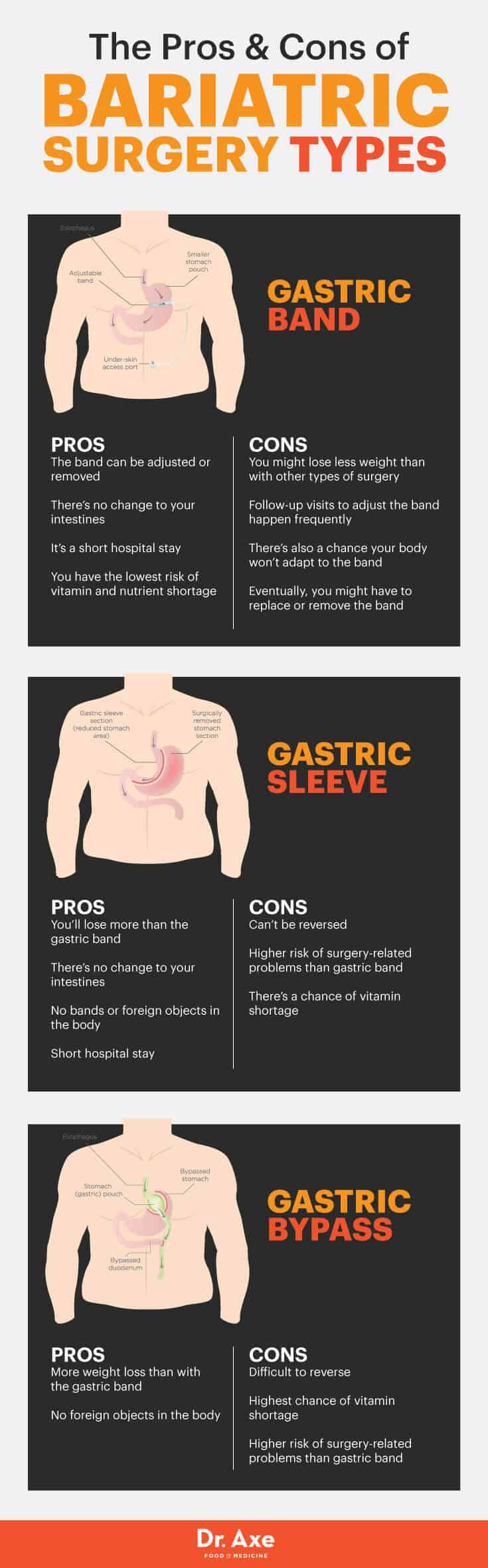 The pros and cons of bariatric surgery - Dr. Axe