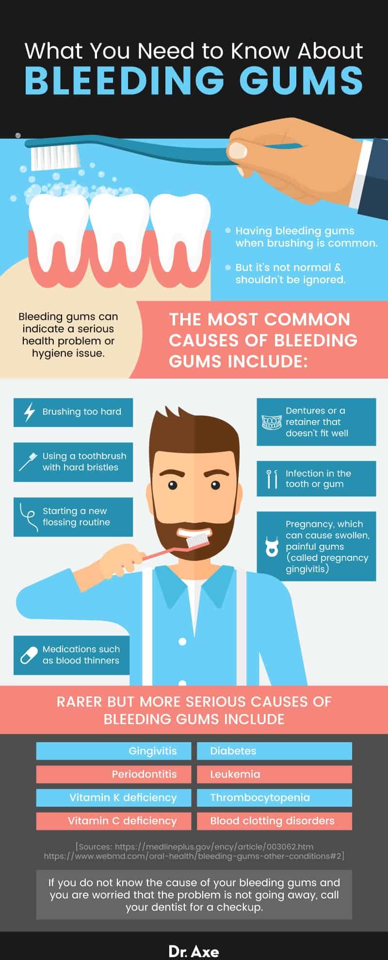 All about bleeding gums - Dr. Axe