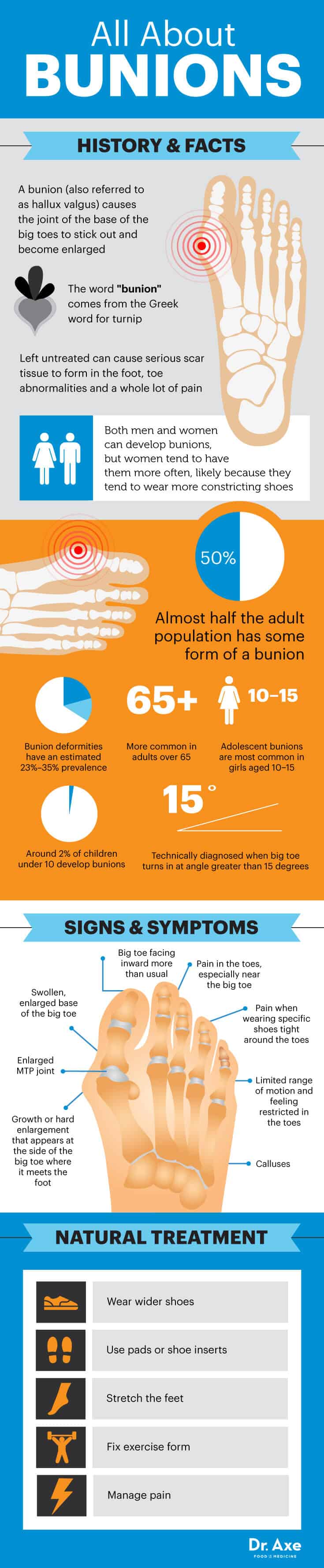 All about bunions - Dr. Axe