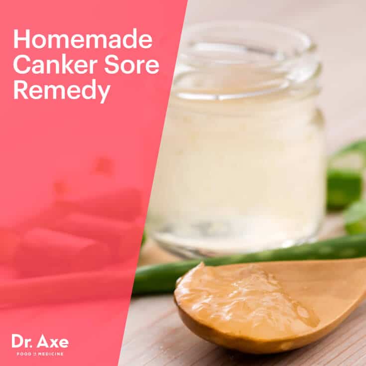 Canker sore remedy - Dr. Axe