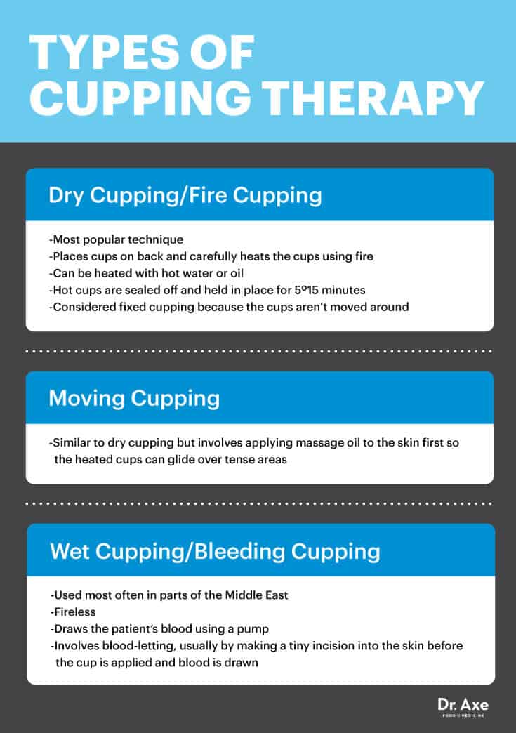 Types of cupping - Dr. Axe