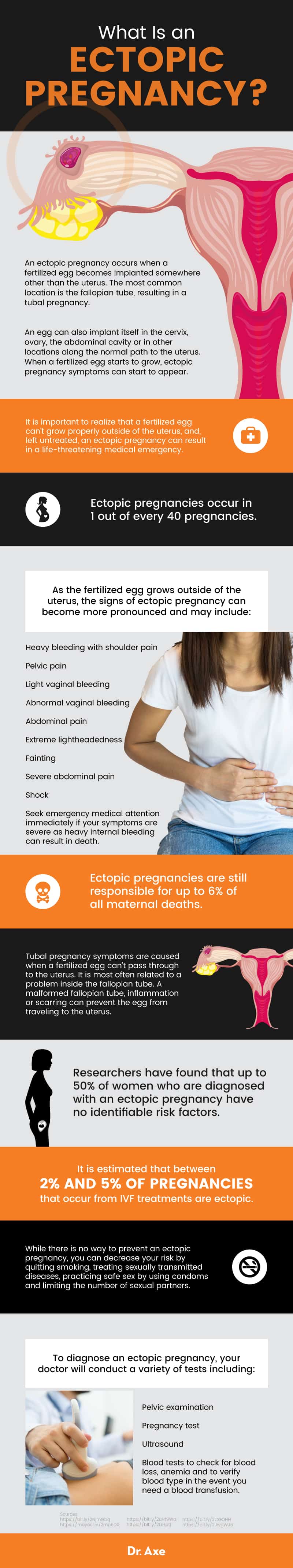 What is an ectopic pregnancy? - Dr. Axe