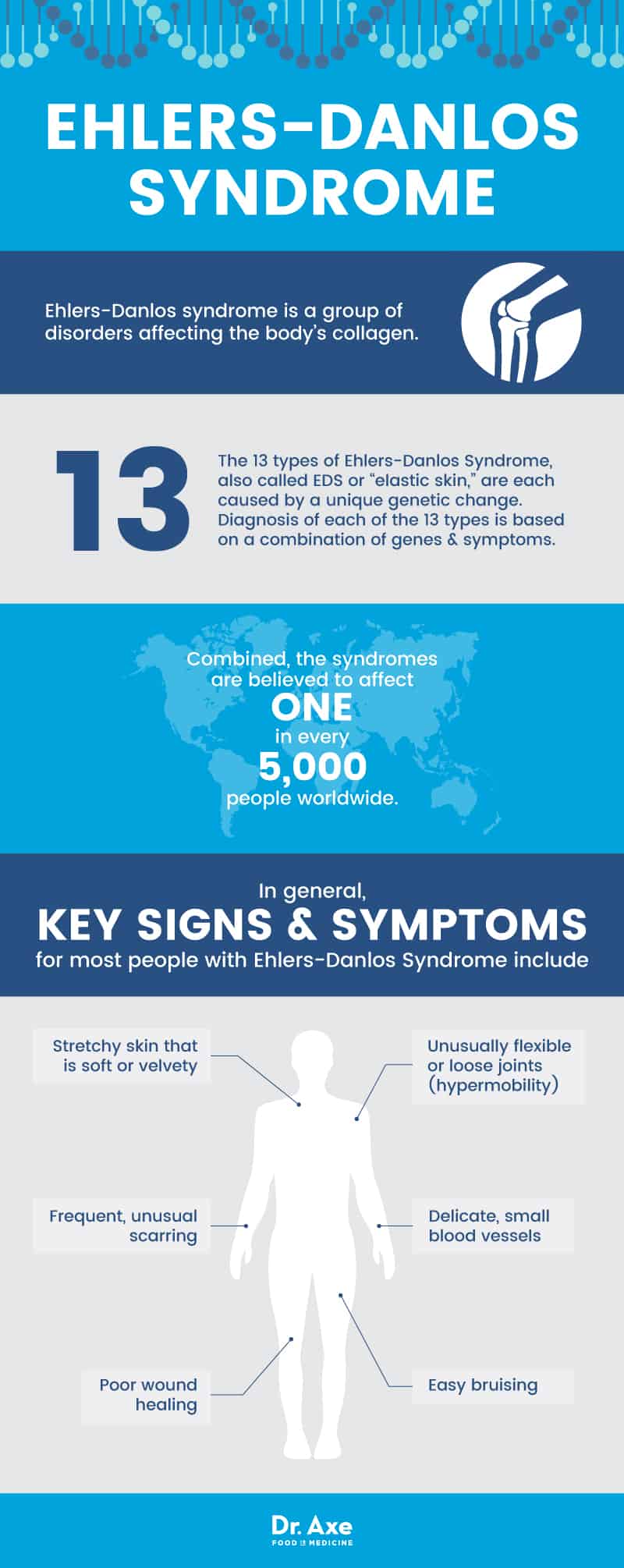 Ehlers-Danlos syndrome - Dr. Axe