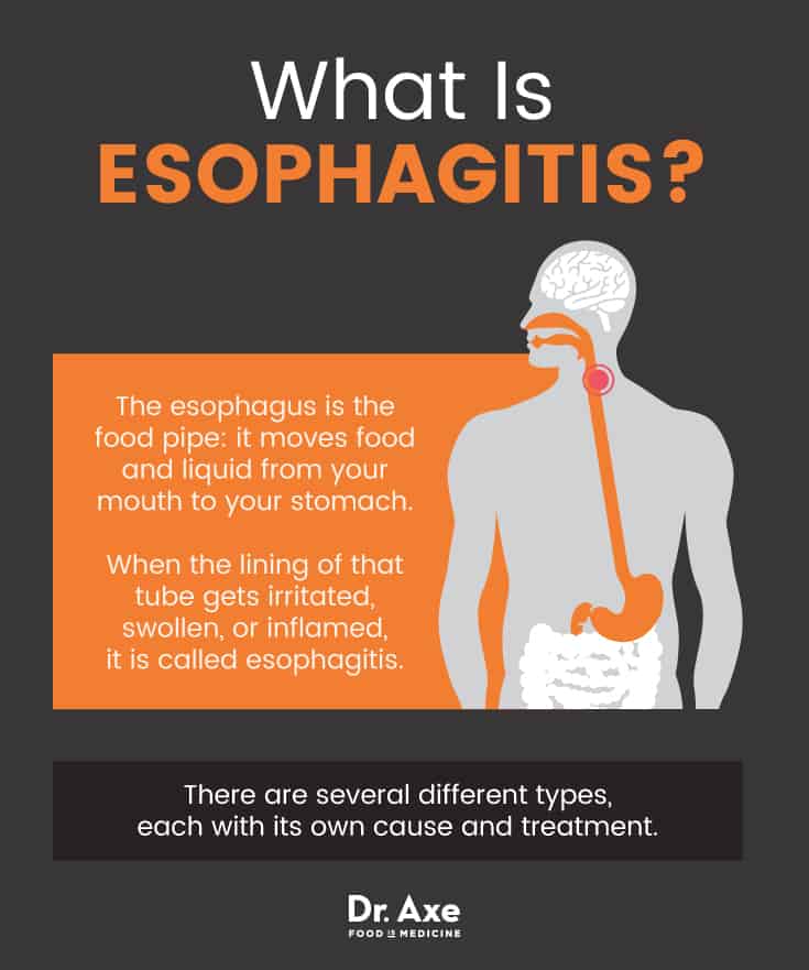 What is esophagitis? - Dr. Axe