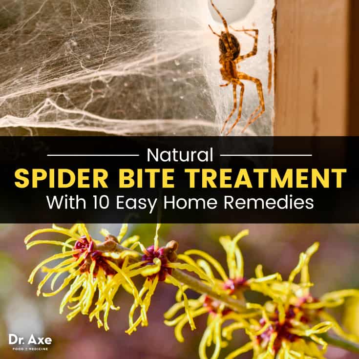 天然蜘蛛咬伤治疗：10种简单的家庭疗法|苦荞之家