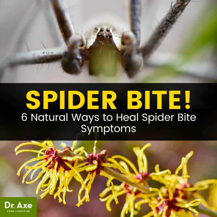 蜘蛛咬伤症状+6种简单自然疗法|苦荞之家