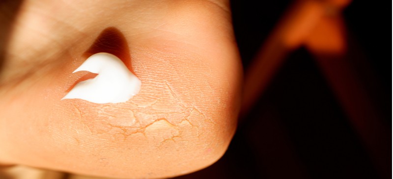 尿素霜有益于干燥、破裂的皮肤及更多|苦荞之家