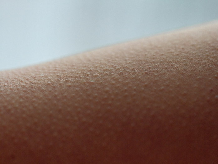 Close-up of skin with goosebumps