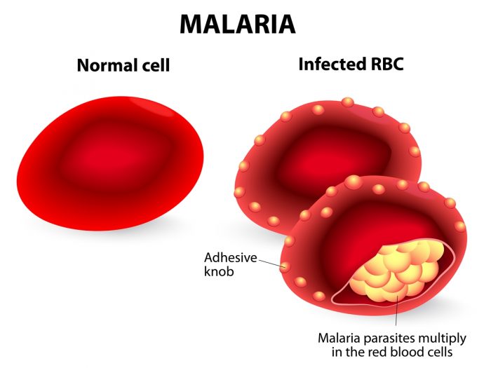 11治疗疟疾的有效自然疗法|苦荞之家