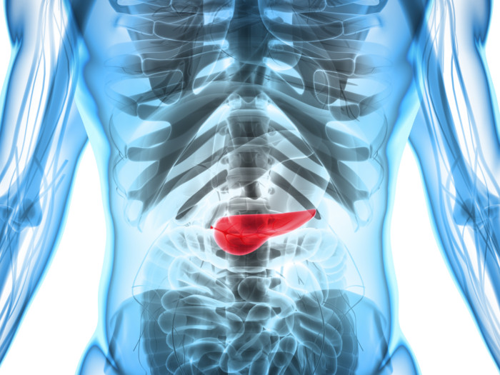 An x-ray image of pancreatitis